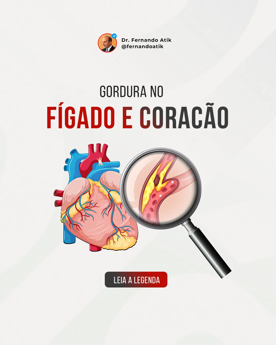Post: Gordura no fígado e coração