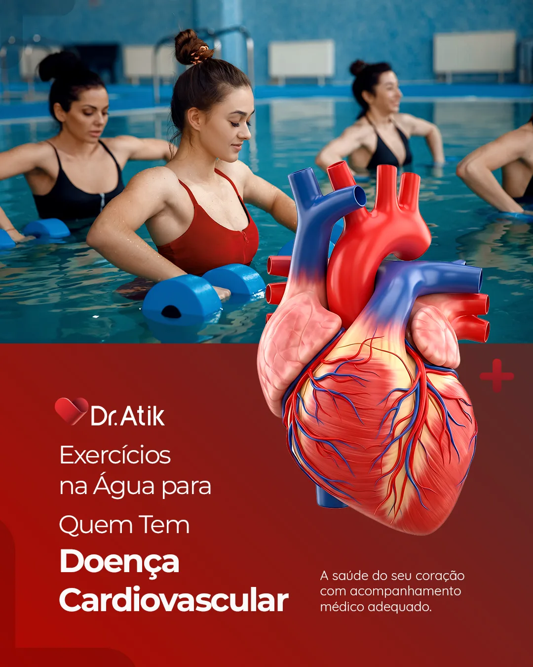 Post: Exercícios na água para quem tem doença cardiovascular