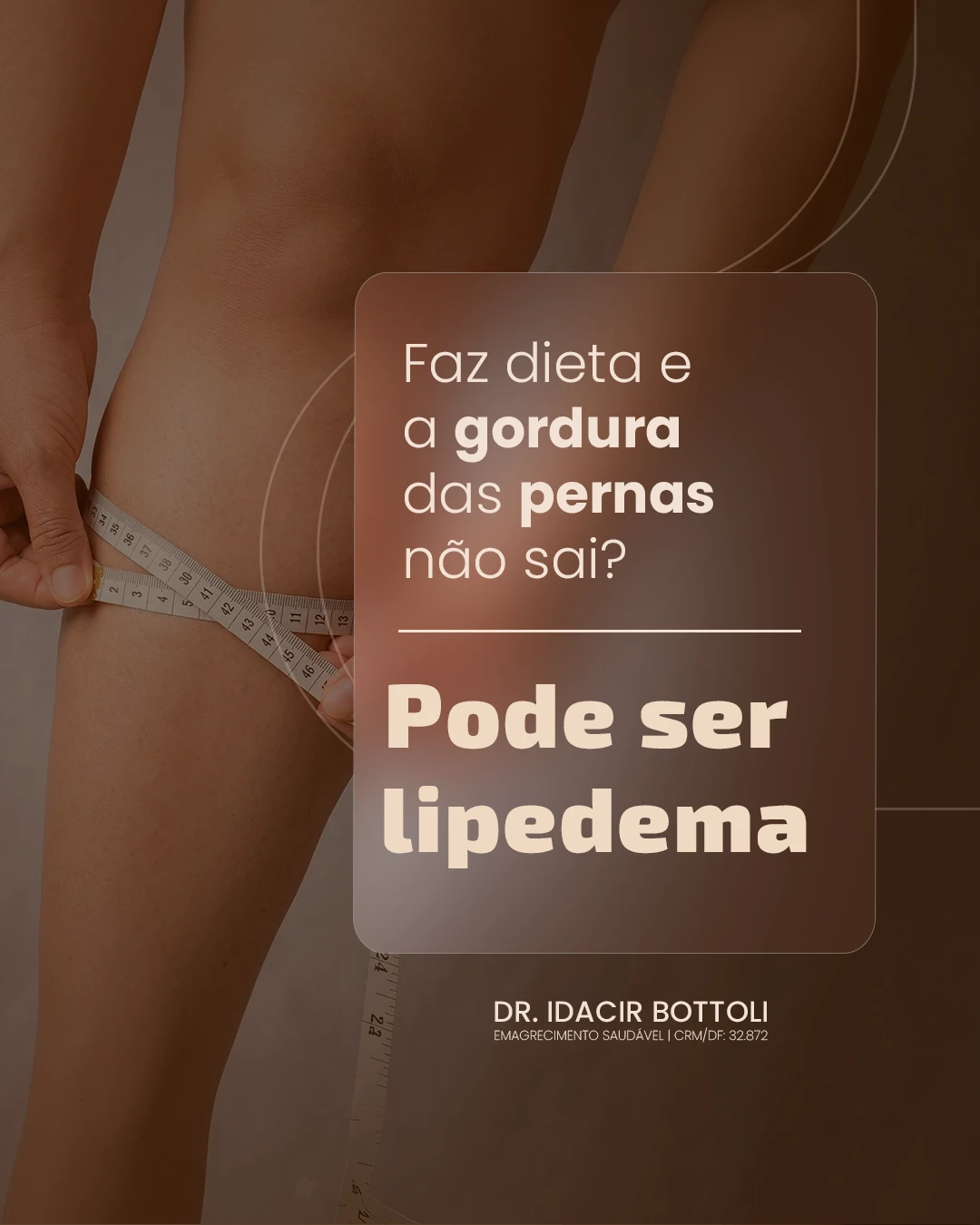 Post: Faz dieta e a gordura das pernas não sai? Pode ser lipedema